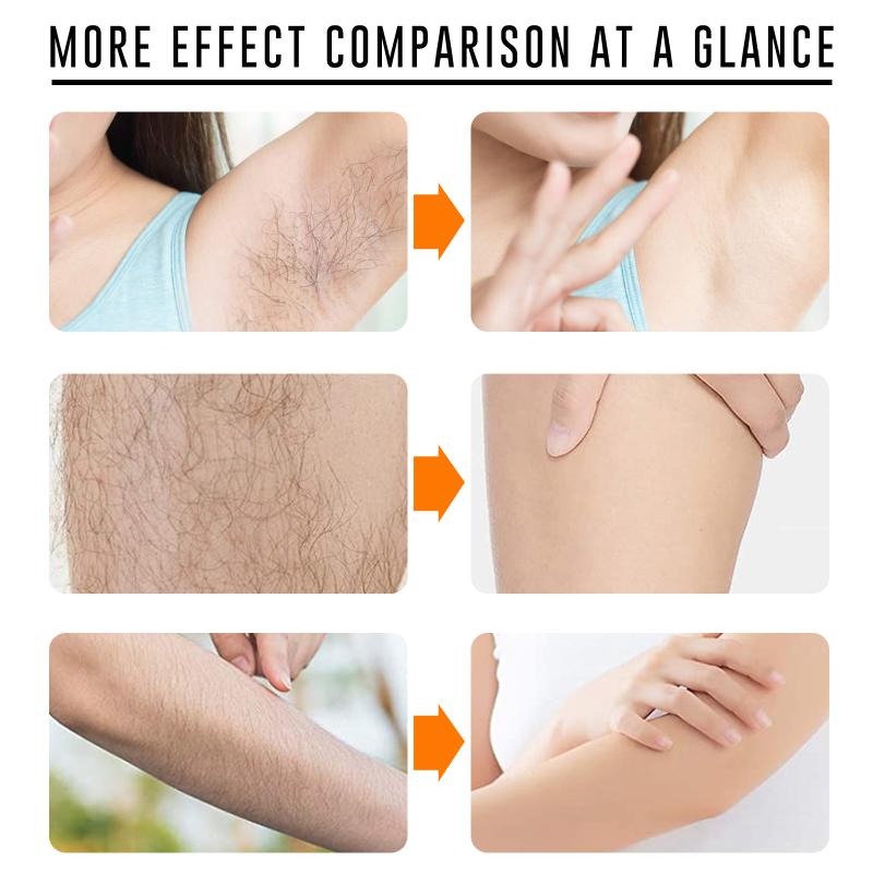 Hair Care Women - Fast Hair Removal Spray Painless Hair
